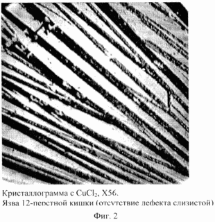 СПОСОБ ДИАГНОСТИКИ ЯЗВЕННОЙ БОЛЕЗНИ ЖЕЛУДКА И 12-ПЕРСТНОЙ КИШКИ